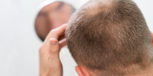 Caduta dei capelli? Problemi e soluzioni